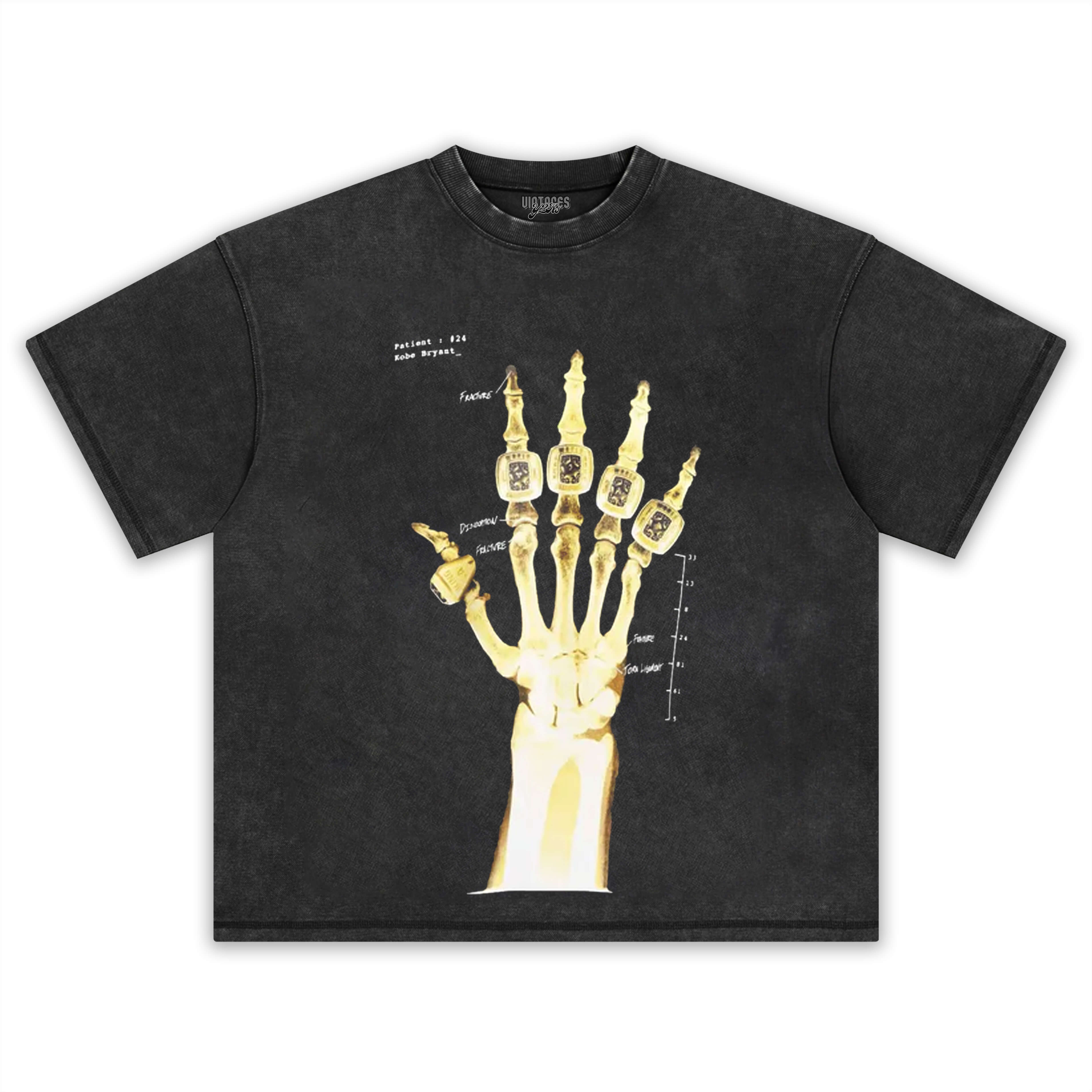 KOBE X-RAY “BROKEN NOT BEATEN” TEE